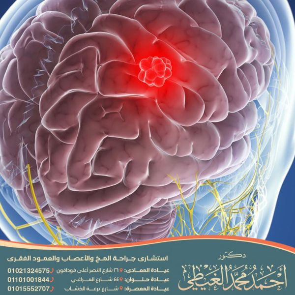 نسبة الشفاء من الورم السحائي