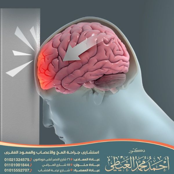 أضرار المياه على المخ