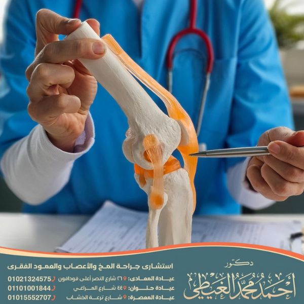 أضرار عملية الغضروف الهلالي