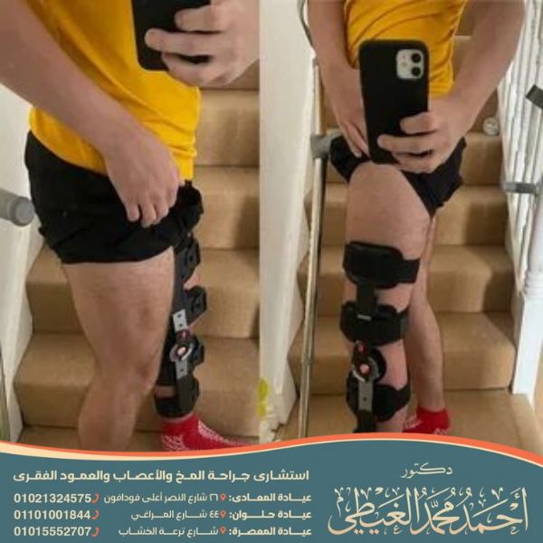 أعراض ضمور عضلات الساق