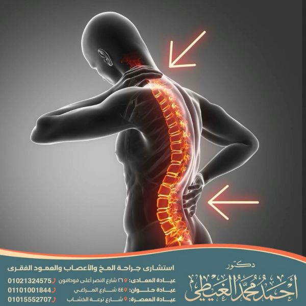 اصلاح اعوجاج العمود الفقري