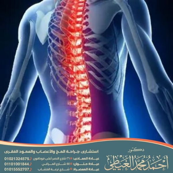 اصلاح اعوجاج العمود الفقري