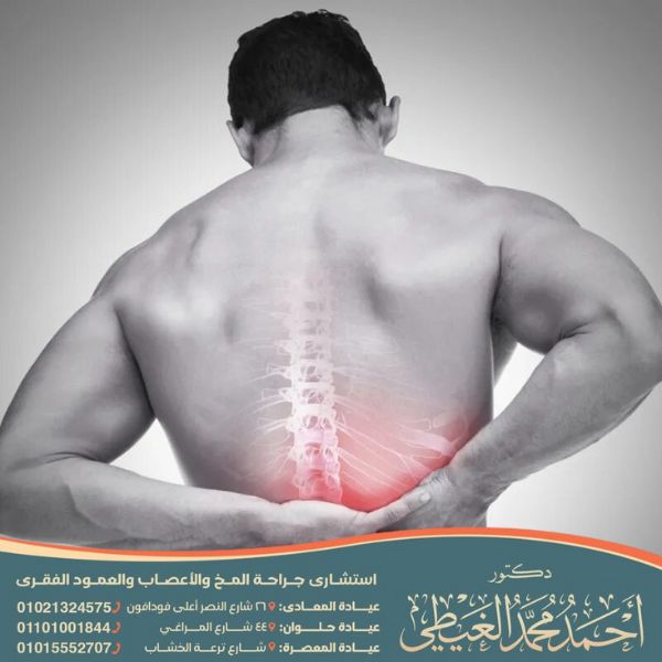 التهاب جذور الأعصاب القطنية