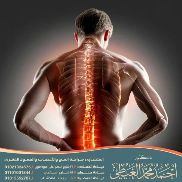 التهاب جذور الأعصاب القطنية