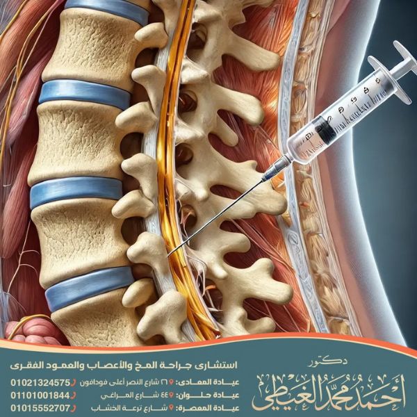 تكلفة عملية حقن جذور الأعصاب