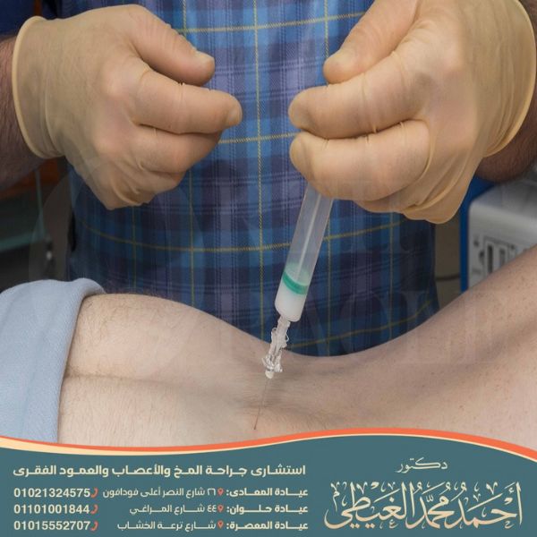 تكلفة عملية حقن جذور الأعصاب