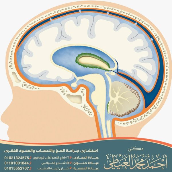 عملية سحب الماء من الرأس عند الأطفال