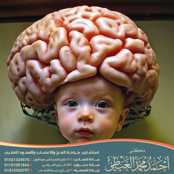 عملية سحب الماء من الرأس عند الأطفال