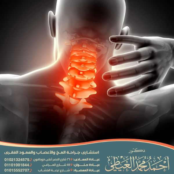 أعراض ضغط فقرات الرقبة على الرأس