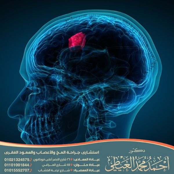 أعراض ورم الرأس في بدايته