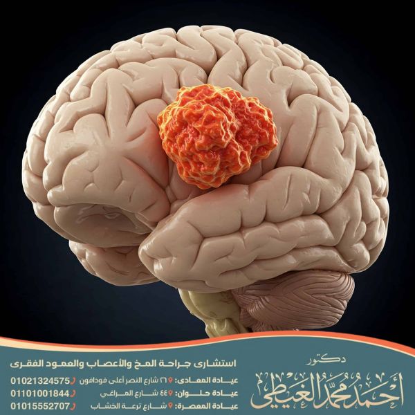 أعراض ورم الرأس في بدايته