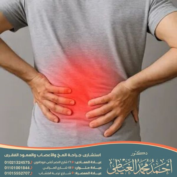 ألم أسفل الظهر الشديد