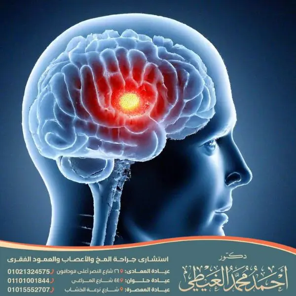 اسباب الورم في الرأس