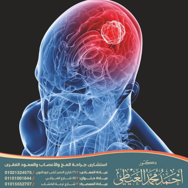 اعراض ورم الراس من الخلف