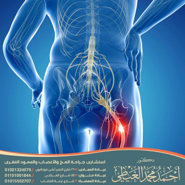 الم عرق الساق