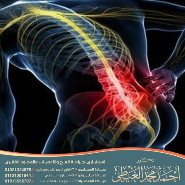 الم عرق الساق