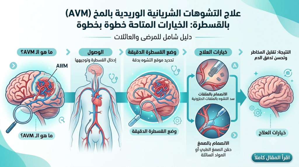 علاج التشوهات الشريانية الوريدية بالقسطرة